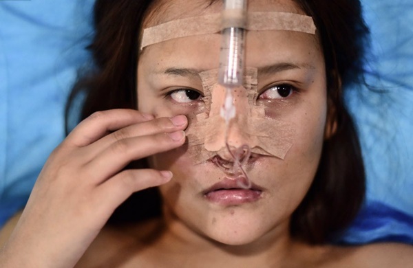 Những cô gái đập mặt xây lại ở Trung Quốc: Đời sang trang nhờ diện mạo mới đến nỗi xem bác sĩ thẩm mỹ là cha mẹ thứ 2-3