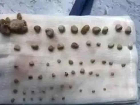 6 loại đồ uống giúp lọc thận sạch tự nhiên, không cần dùng thuốc-7