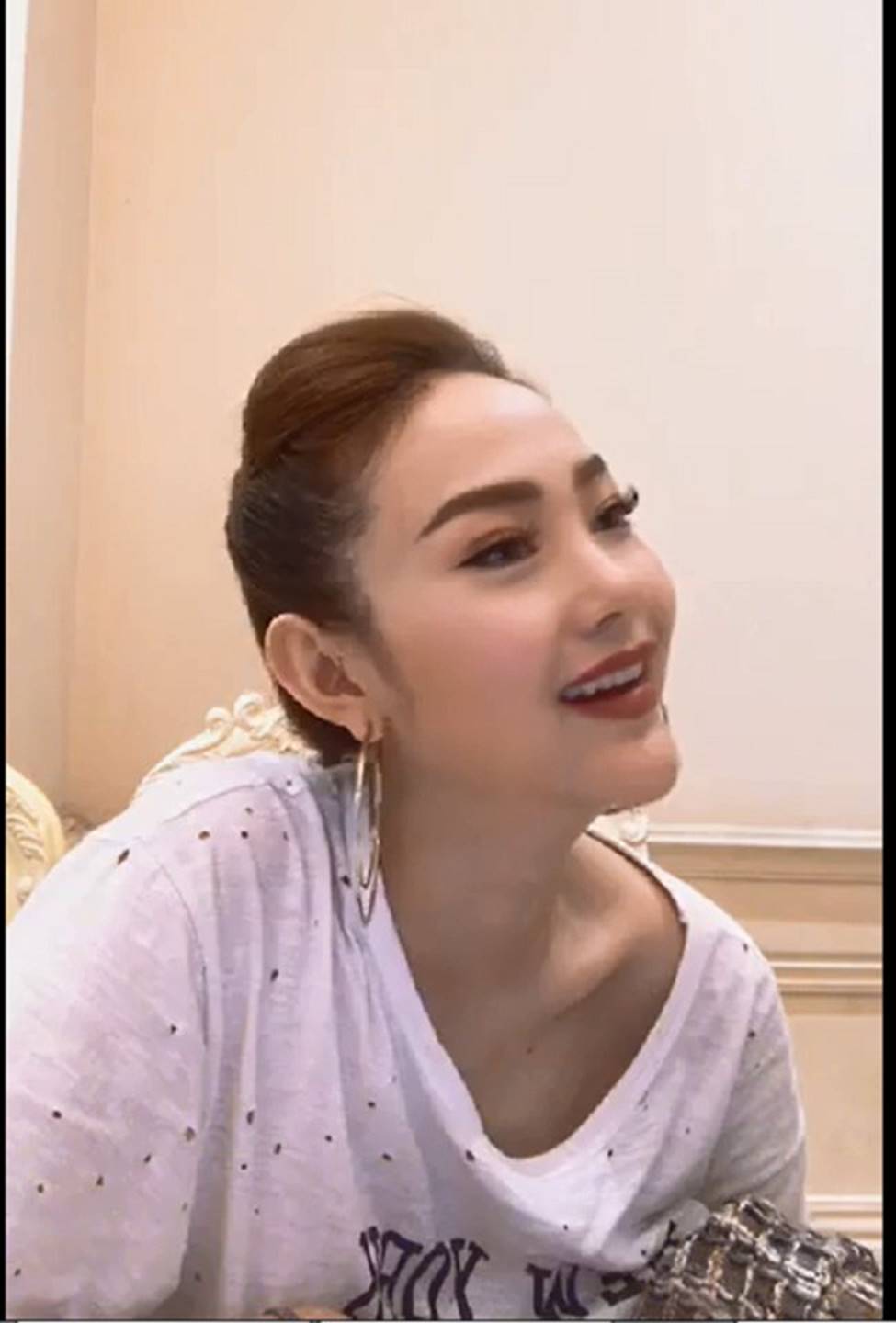 My sói khiến fan hết hồn vì mặt biến dạng, cằm dài ngoằng lạ lẫm-13