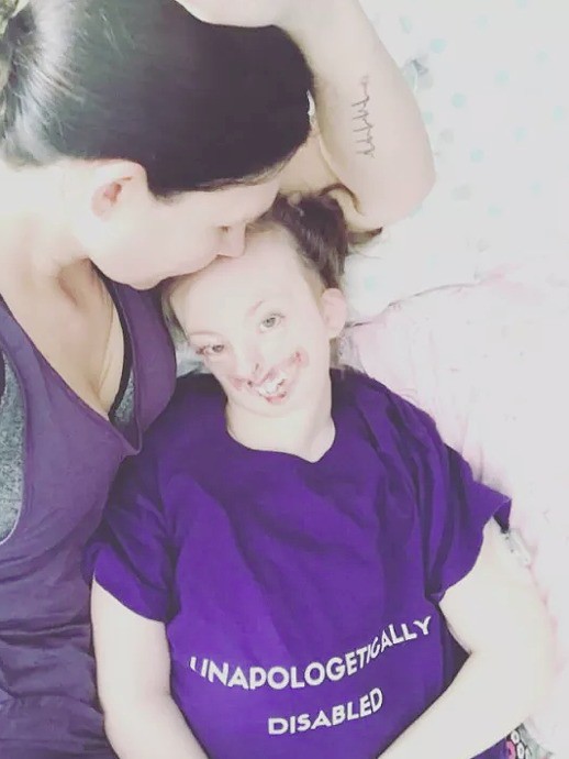 Bé gái từng bị miệt thị công khai vì diện mạo khiếm khuyết gây xúc động MXH, trút hơi thở cuối cùng ở tuổi lên 10-3