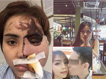Sau khi ký vào tờ giấy kết hôn định mệnh, cô gái bị chồng sắp cưới tạt axit dọa: 'Em mà không lấy tôi thì cả đời này đừng mong lấy ai'