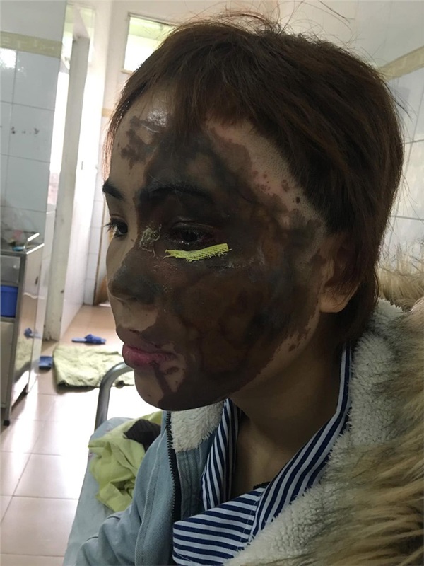 Ở phòng cấp cứu, bố chồng cô gái bị tạt axit vào thăm gây phẫn nộ: Đã sờ thử axit, không vấn đề gì, không bị gì cả!-1