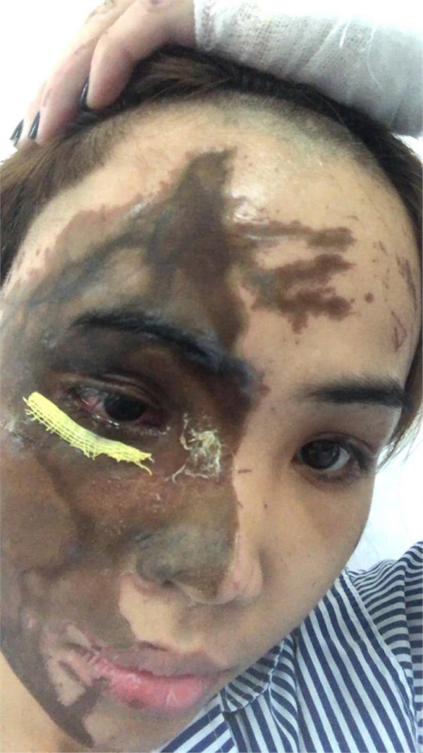 Ở phòng cấp cứu, bố chồng cô gái bị tạt axit vào thăm gây phẫn nộ: Đã sờ thử axit, không vấn đề gì, không bị gì cả!-4