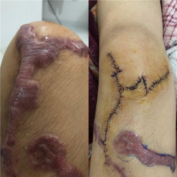 Ở phòng cấp cứu, bố chồng cô gái bị tạt axit vào thăm gây phẫn nộ: Đã sờ thử axit, không vấn đề gì, không bị gì cả!-6