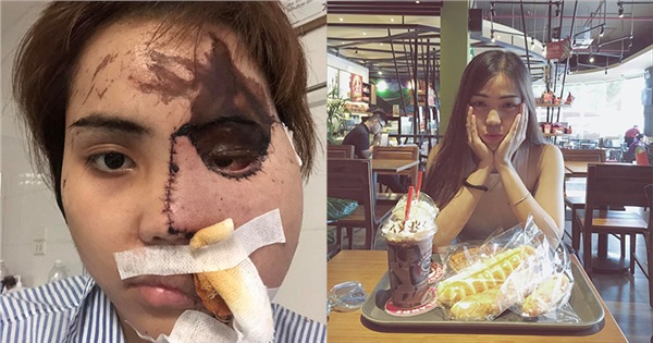 Cô gái bị chồng sắp cưới tạt axit đau đớn tiết lộ: Lời cuối cùng anh ta nói với bố em là Xem lại con gái ông đi-3