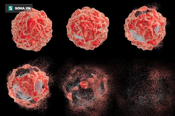 Ai tránh được 6 việc này thì ít mắc ung thư: Hãy nhớ bệnh lớn bắt đầu từ thói quen nhỏ-1