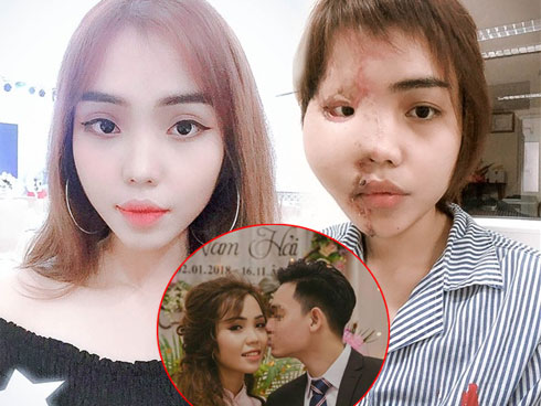 Vụ thiếu úy công an tạt axit vợ sắp cưới ở Đà Nẵng: Đối tượng lên kế hoạch ra sao?-2