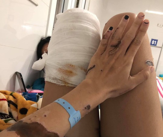 Vụ thiếu úy công an tạt axit vợ sắp cưới ở Đà Nẵng: Đối tượng lên kế hoạch ra sao?-1