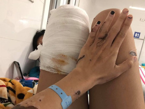 Bình Dương: Liên tiếp phát hiện 2 người chết bất thường trong phòng trọ-3