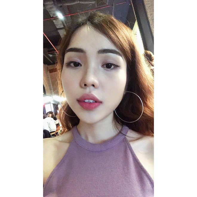 Nỗi đau tột cùng của cô gái bị chồng sắp cưới tạt axit biến dạng gương mặt: Đêm tôi không dám ngủ vì giây phút ấy lại hiện về-3