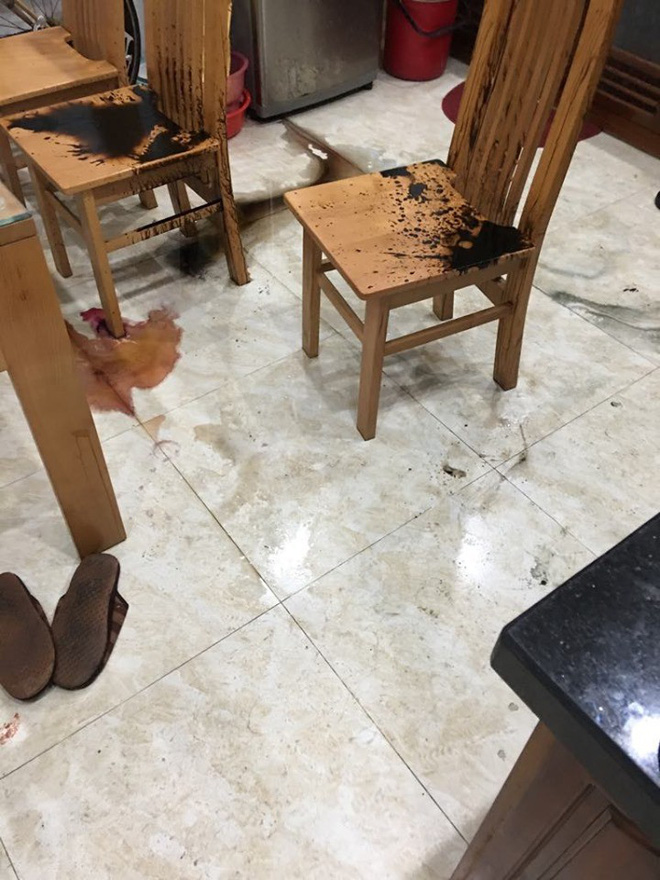 Nỗi đau tột cùng của cô gái bị chồng sắp cưới tạt axit biến dạng gương mặt: Đêm tôi không dám ngủ vì giây phút ấy lại hiện về-8