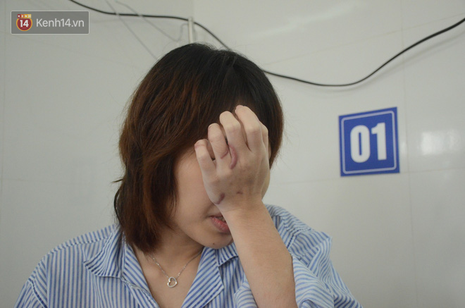 Nỗi đau tột cùng của cô gái bị chồng sắp cưới tạt axit biến dạng gương mặt: Đêm tôi không dám ngủ vì giây phút ấy lại hiện về-14