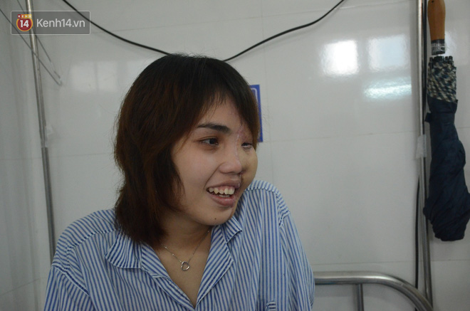 Nỗi đau tột cùng của cô gái bị chồng sắp cưới tạt axit biến dạng gương mặt: Đêm tôi không dám ngủ vì giây phút ấy lại hiện về-18