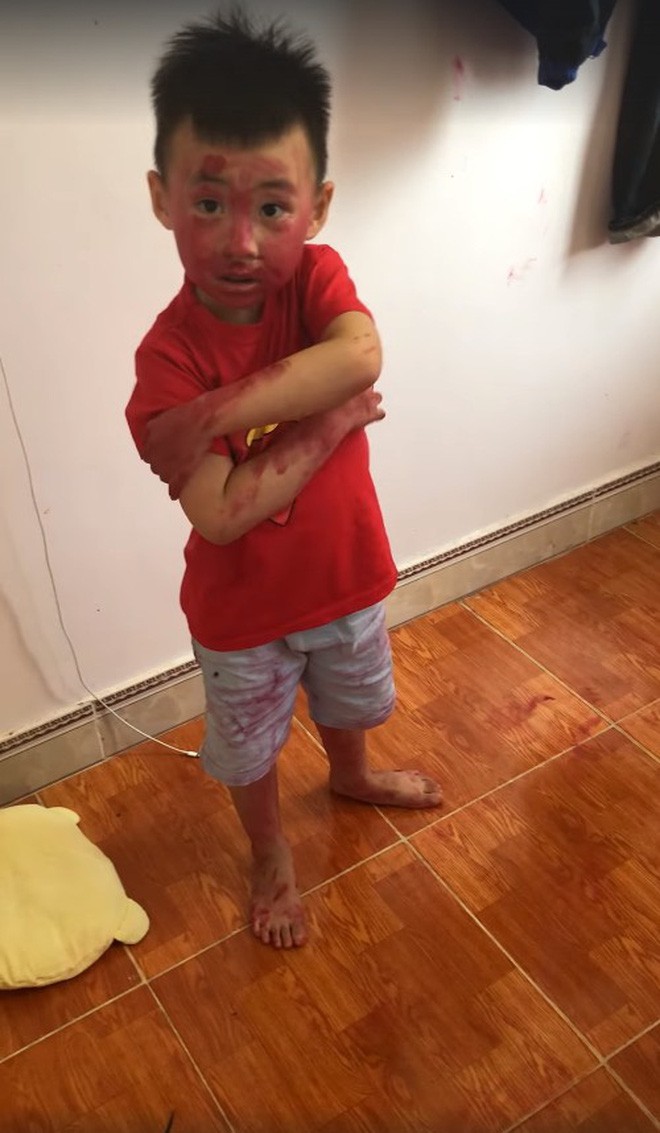Sự im ắng khác thường trong phòng và 2 cậu con trai mặt mũi bê bết vết đỏ khiến mẹ trẻ đứng hình, cười trong nước mắt-2