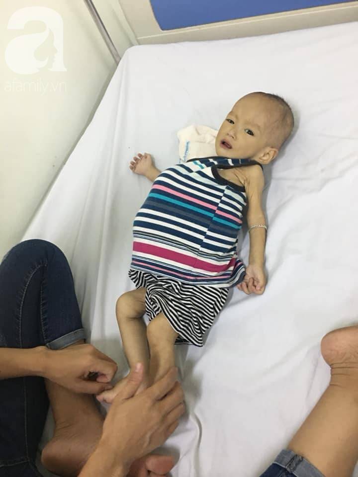 Sự sống mong manh của bé trai 1 tuổi, chỉ nặng 6kg, bụng phình to như cái trống mà mẹ nghèo không tiền chữa trị-3