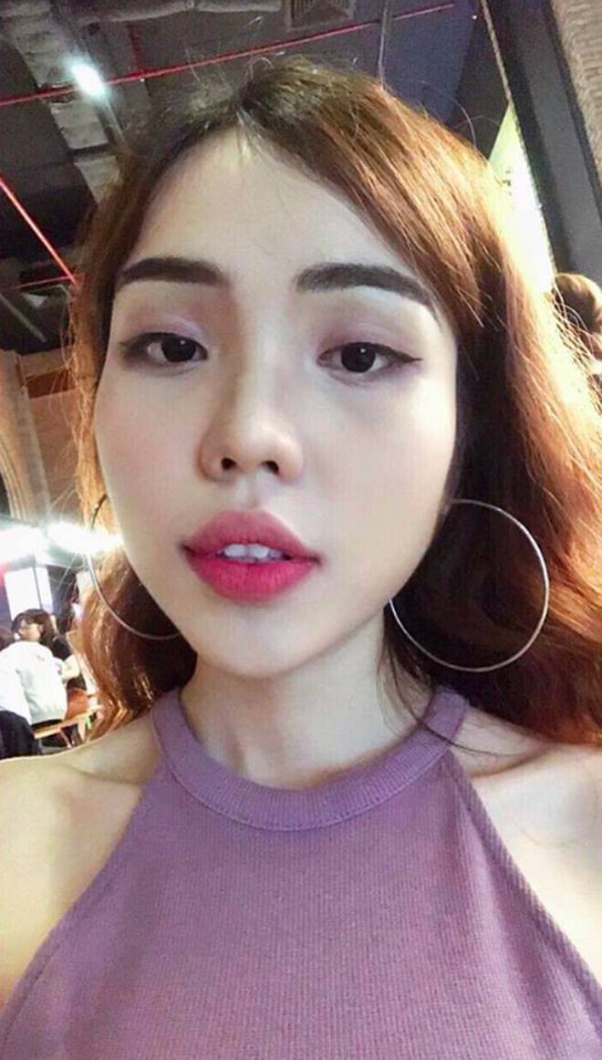 Bố của cô gái bị chồng sắp cưới tạt axit biến dạng gương mặt: Nó làm thế còn đau đớn hơn giết người-3