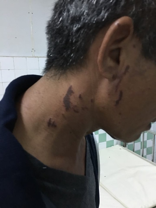 Bố của cô gái bị chồng sắp cưới tạt axit biến dạng gương mặt: Nó làm thế còn đau đớn hơn giết người-8