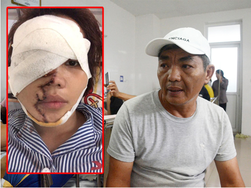 Vụ tạt axit vợ chưa cưới: Xử mức án cao nhất của khung hình phạt-3