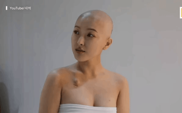 Nhật ký ung thư đầy lạc quan của Beauty Blogger Hàn Quốc: Nụ cười luôn thường trực trên môi, rồi tóc sẽ mọc lại thôi-6