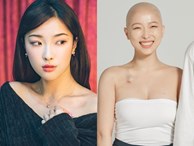 Nhật ký ung thư đầy lạc quan của Beauty Blogger Hàn Quốc: Nụ cười luôn thường trực trên môi, 'rồi tóc sẽ mọc lại thôi'