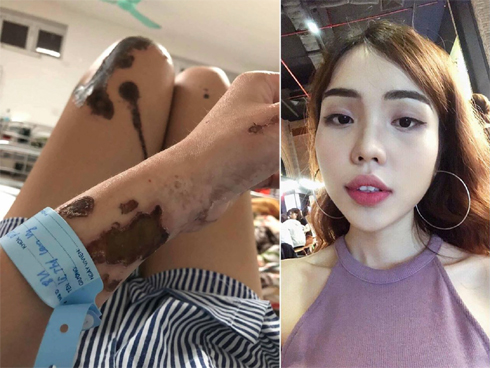 Giọt nước mắt của mẹ cô gái bị chồng sắp cưới tạt axit-1