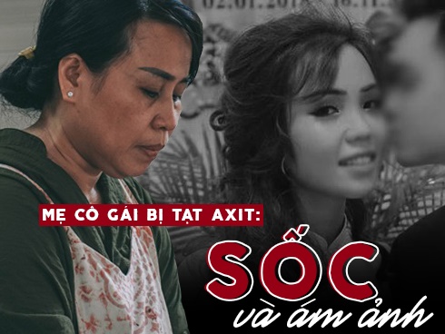 Bác sĩ kể lại hành trình hồi sinh gương mặt xinh đẹp cho cô gái bị thiếu úy tạt axit-5