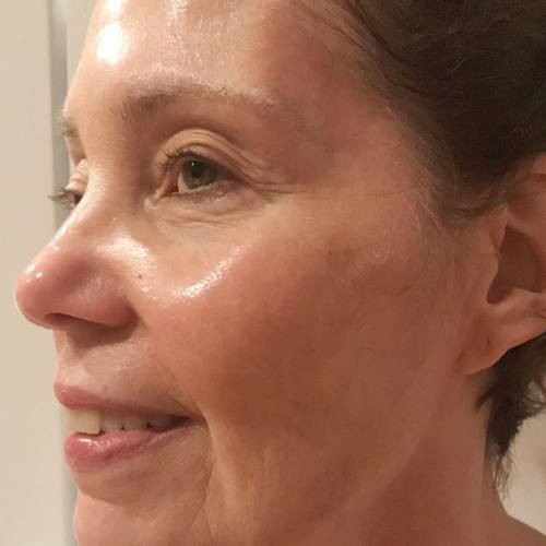 Ngoài 70 nhưng da căng bóng như 30, người phụ nữ tiết lộ 7 chai serum mình dùng và cách mix 3 loại thần thánh-2