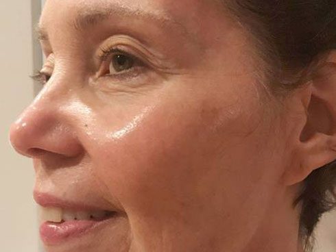 8 loại serum vitamin C ngừa da nám và chống lão hóa giá dưới 350k mà chị em nào cũng cần trong công cuộc chống già”-9