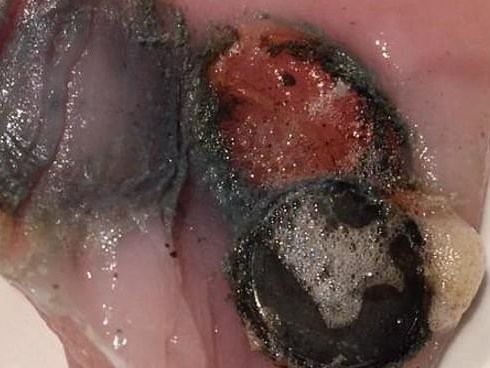 Hiểm họa khó lường từ đồ chơi trẻ em: Cha mẹ chủ quan, con nhập viện hoặc tử vong trong phút chốc-10