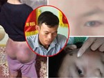 Nghi vấn thiếu nữ thiểu năng trí tuệ bị gã hàng xóm hiếp dâm phải sinh con ở Thái Bình-2