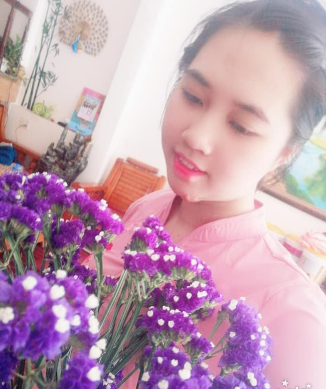 Nỗi đau của người vợ bị chồng tẩm xăng thiêu sống, bỏng 79% cơ thể: Hi sinh tất cả vì 1 người đàn ông rồi cuối cùng suýt mất cả mạng-1