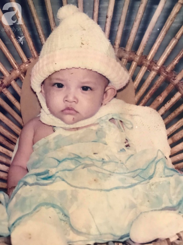 Bé gái biến dạng khuôn mặt, mất một bên tai và ước mơ nhói lòng: Em muốn làm họa sĩ để vẽ mình đẹp hơn-1