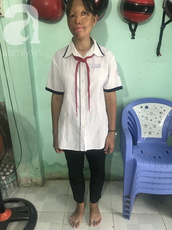 Bé gái biến dạng khuôn mặt, mất một bên tai và ước mơ nhói lòng: Em muốn làm họa sĩ để vẽ mình đẹp hơn-7