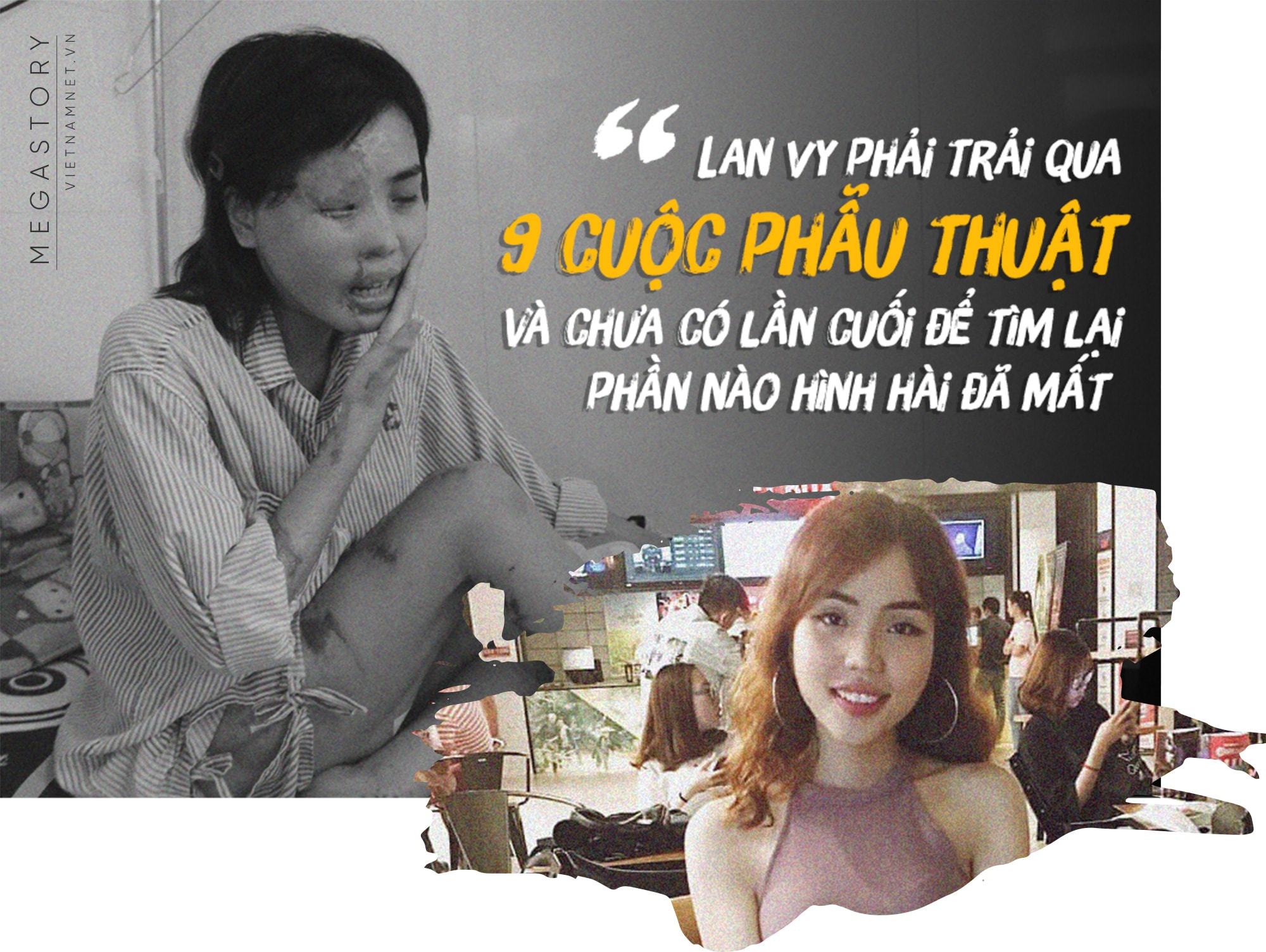 Phía sau gương mặt của người đàn bà đẹp bị tạt axit-1