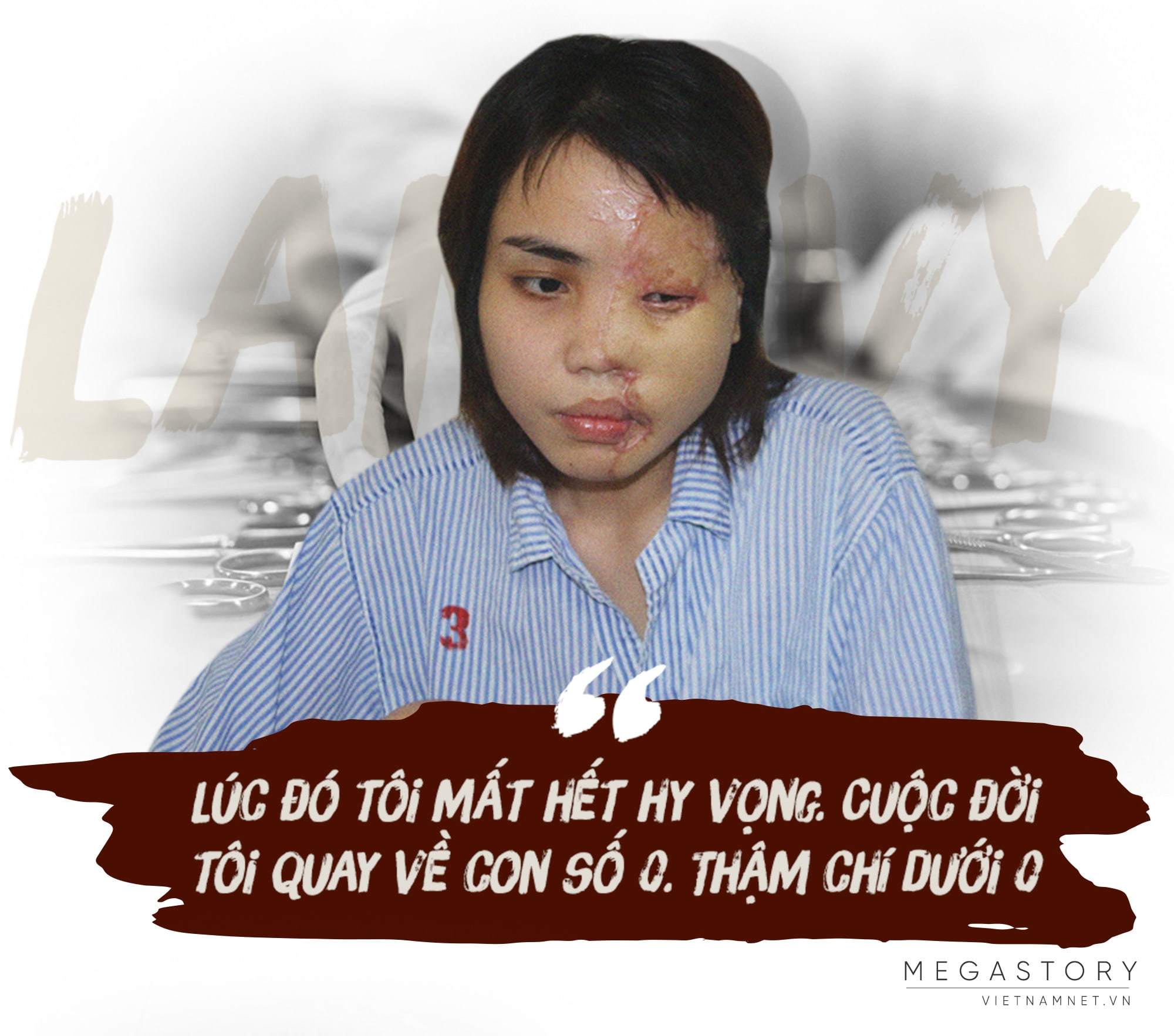 Phía sau gương mặt của người đàn bà đẹp bị tạt axit-2