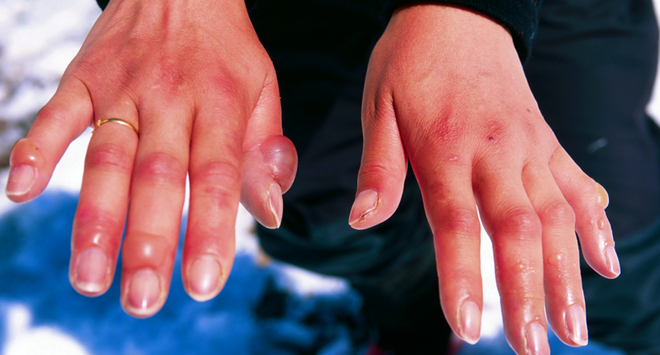 Chuyên gia chỉ 8 cách sơ cấp cứu ai cũng cần phải biết: Ghi nhớ để cứu sống nhiều người-4