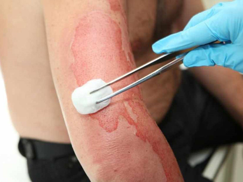 Mẹ bầu sinh con ra mặt mũi bầm tím do thói quen ăn uống cực có hại này trong thai kỳ-4