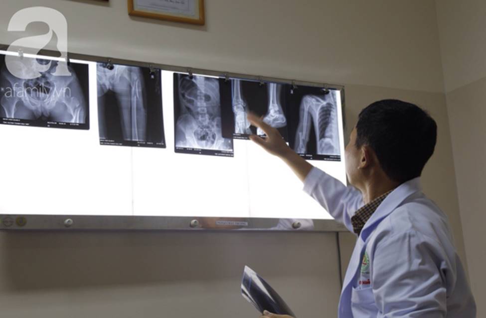 TP.HCM: Bị gia đình ngăn lấy chồng, thanh niên 22 tuổi nhảy từ lầu 4 chung cư dẫn đến chấn thương nặng-3