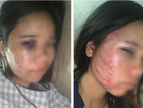 Đoàn hóa trang Tôn Ngộ Không bị đánh bầm dập ở Sa Pa-1