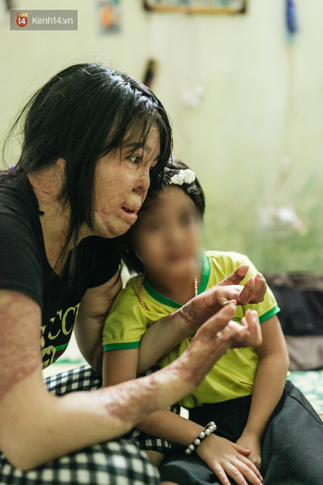 Cô gái trẻ bị chồng tưới xăng thiêu sống và lá thư muộn màng từ trại giam: Gần 3 năm anh chưa một lần dám viết thư cho em và hai con...-9