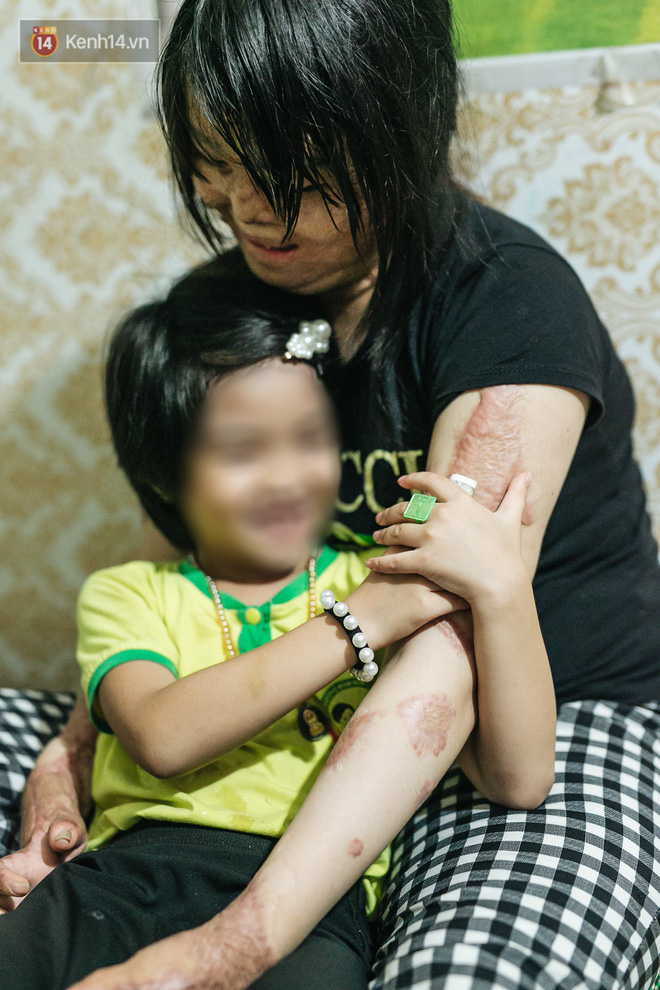 Cô gái trẻ bị chồng tưới xăng thiêu sống và lá thư muộn màng từ trại giam: Gần 3 năm anh chưa một lần dám viết thư cho em và hai con...-11