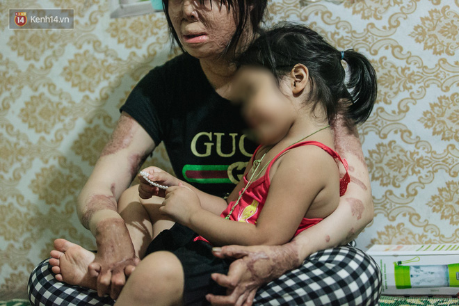 Cô gái trẻ bị chồng tưới xăng thiêu sống và lá thư muộn màng từ trại giam: Gần 3 năm anh chưa một lần dám viết thư cho em và hai con...-10