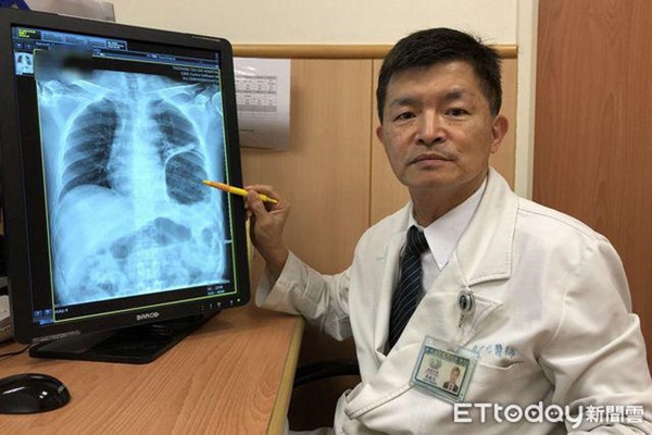 Dạ dày người đàn ông chạy lên phổi, vỡ cơ hoành do làm điều này khi đi vệ sinh-2