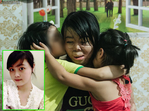 Cô gái Yên Bái bị chồng MC tẩm xăng đốt 3 năm trước giờ ra sao?-6