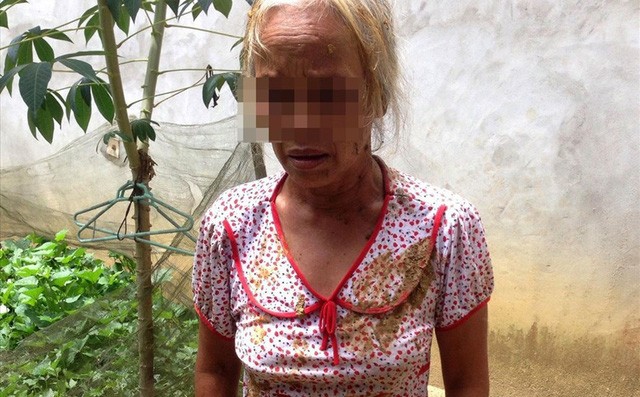 Mâu thuẫn đất đai, hai thanh niên nhét phân bò vào miệng bà già-1