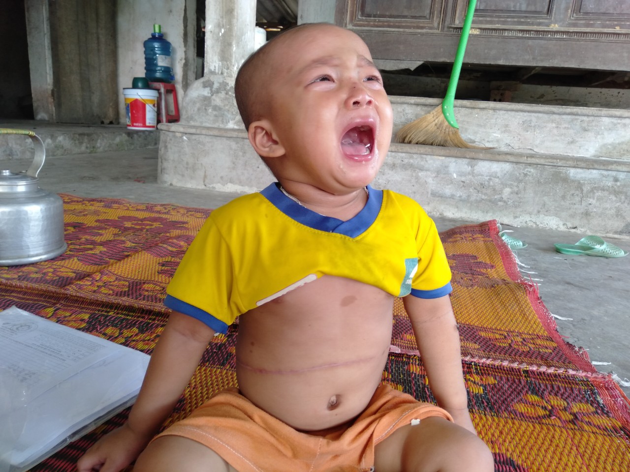 Tiếng khóc xé lòng của bé gái 3 tuổi mắc bệnh hiểm nghèo: Bà ơi, cháu đau lắm, sao bố mẹ mãi không về hả bà?-1