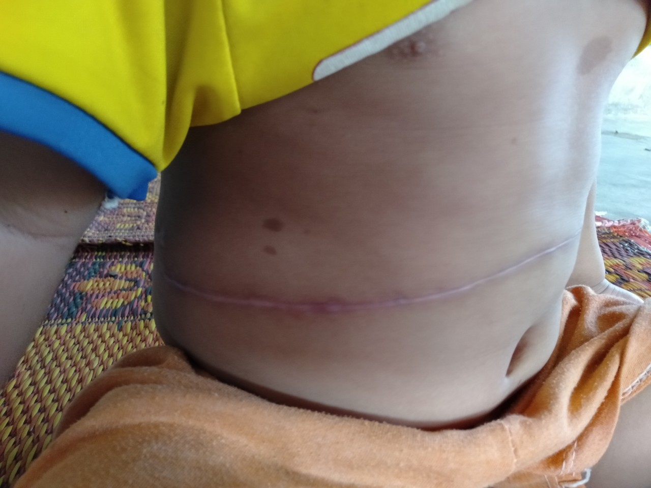 Tiếng khóc xé lòng của bé gái 3 tuổi mắc bệnh hiểm nghèo: Bà ơi, cháu đau lắm, sao bố mẹ mãi không về hả bà?-6