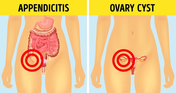 6 căn bệnh thường bị nhầm lẫn với bệnh khác: Chậm trễ điều trị có thể gây nguy hiểm-5