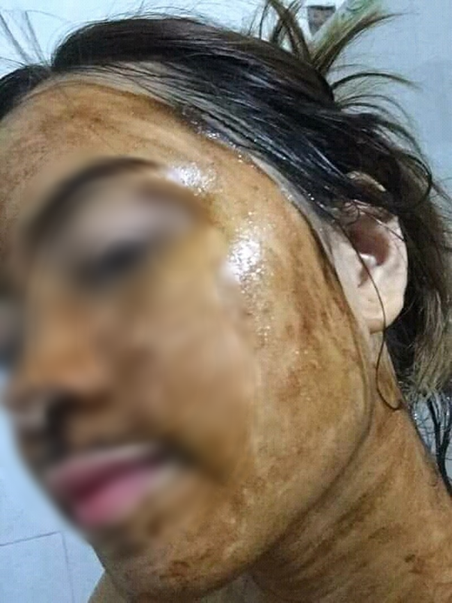 Choáng với độ liều của hội chị em: Tắm trắng gì mà bọc người như xác ướp thế kia?-3