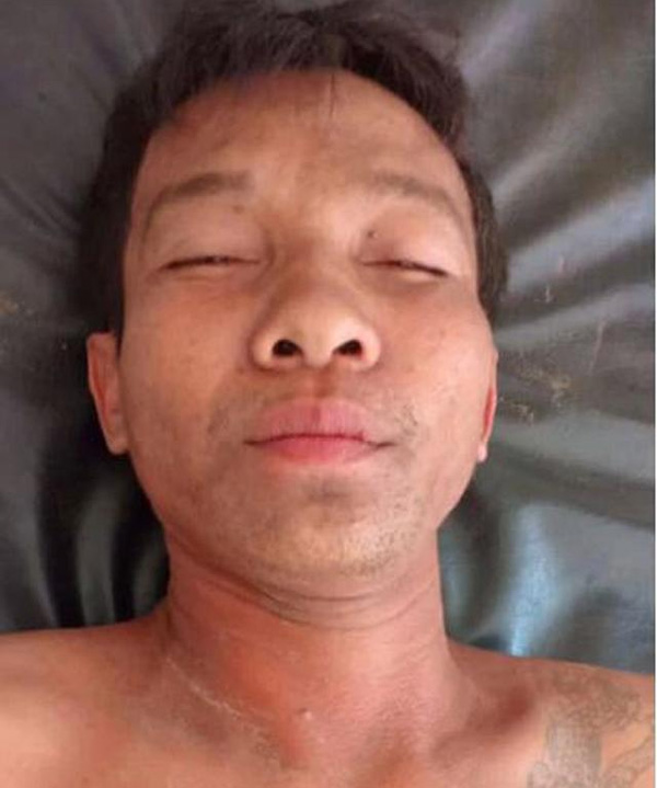 Không chịu xuống ăn sáng cùng vợ, chồng bị cắn đứt của quý kinh hoàng-1